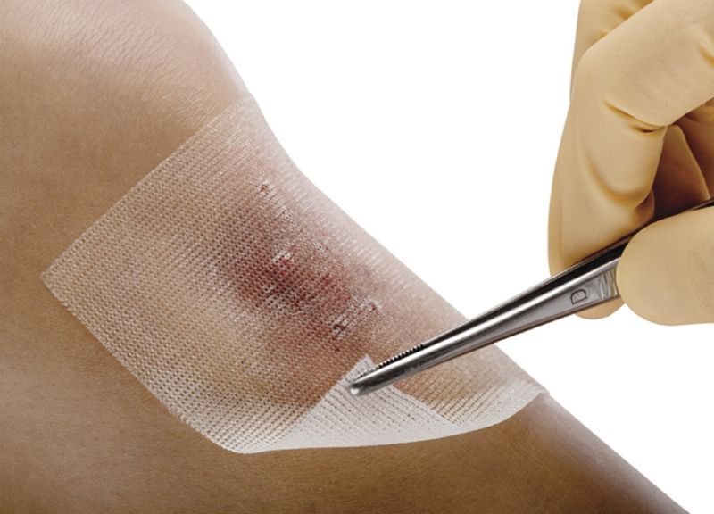 BSN Cuticell C Dressing Gauze 10 cm x 10 cm sterile wound dressing